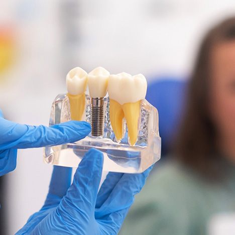 A dentist holding a dental implant model near a blurred patient