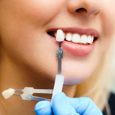 A woman using a tooth shade selector