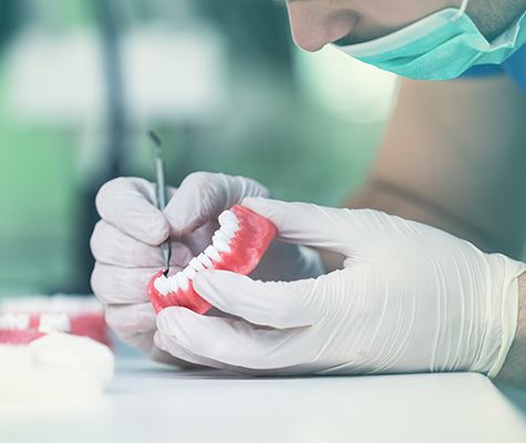 Dental lab technician crafting all on four dental implant denture