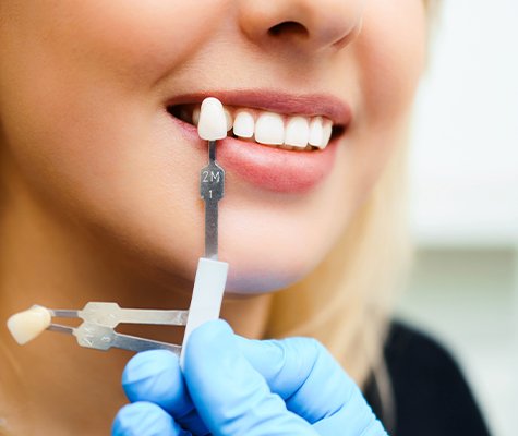 Woman's smile compared with porcelain veneer shade chart during cosmetic dentistry visit