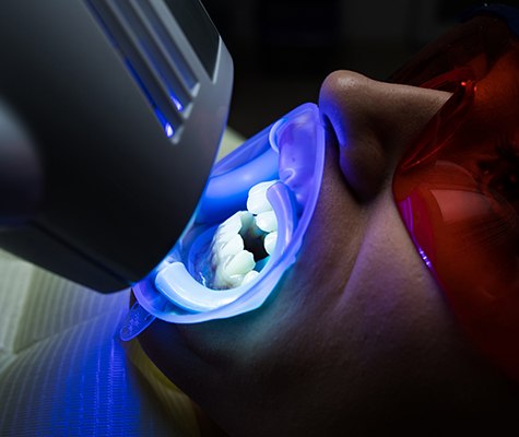 Patient receiving in office teeth whitening