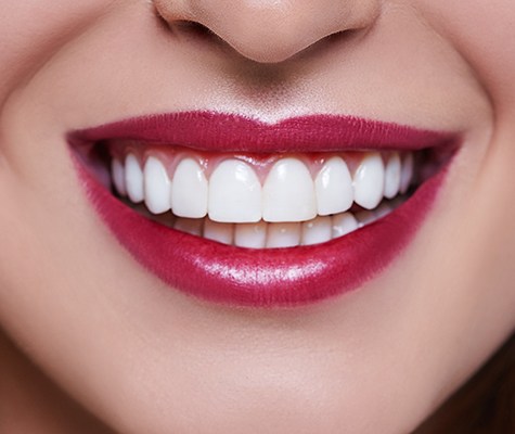 Closeup of smile after gum recontouring