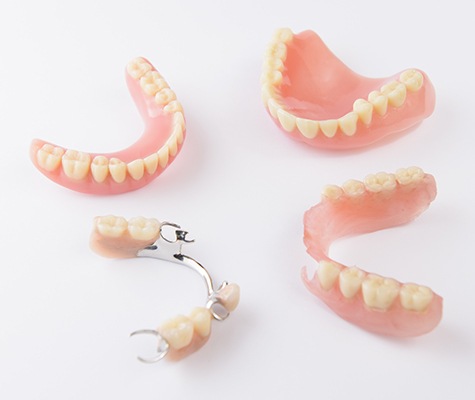 Four types of partial and full dentures