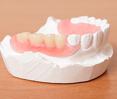 Model smile with partial denture