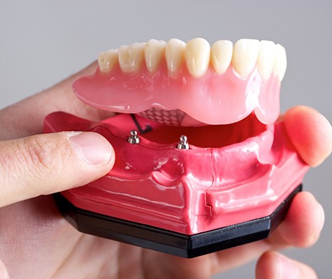 Closeup of dental implant dentures in Lancaster held by dentist