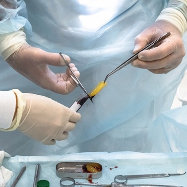 Dentist using PRF