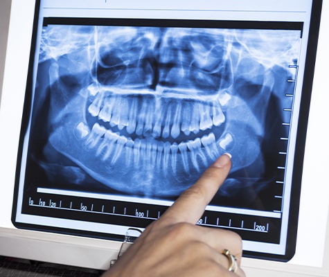 Dentist reviewing digital x-rays on tablet computer
