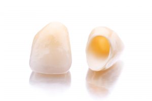 two dental crowns outside and inside