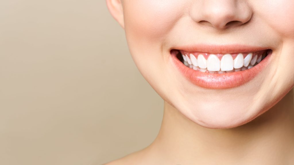 Cosmetic Dentistry San Diego