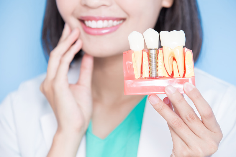 Dentist smiling with a model of dental implants