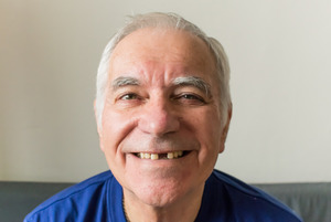Senior man with a missing tooth