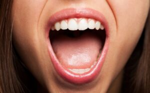 Open mouth. 